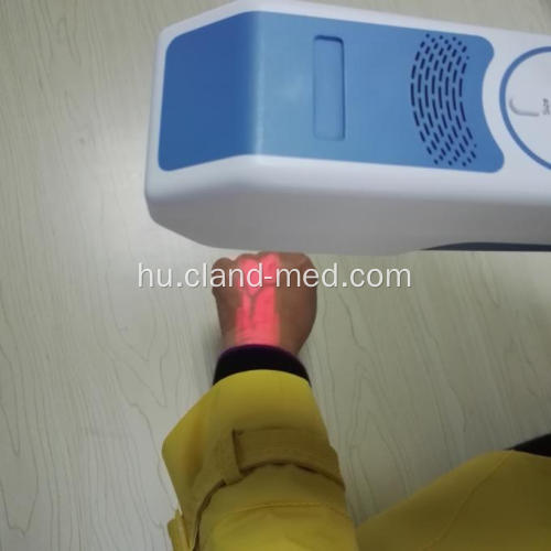 Professzionális kézi CE orvosi infravörös vénafelderítő eszköz
